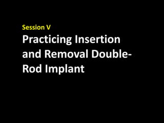 Session V
Practicing Insertion
and Removal Double-
Rod Implant
 