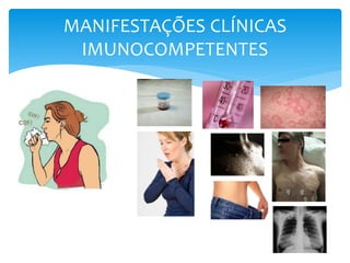 MANIFESTAÇÕES CLÍNICAS
IMUNOCOMPETENTES
 