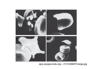 ajcp.ascpjournals.org/.../131/4/560/F4.large.jpg  