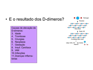 E o resultado dos D-dímeros? Causas de elevação de D-dímeros: Idade Trombose Cirurgias Neoplasia Gestação Insuf. Cardíaca IAM Infecções Doenças inflama- tórias 