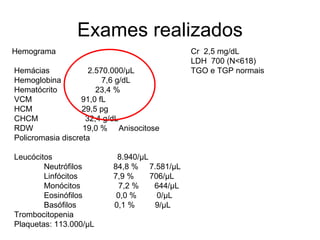 Exames realizados Hemograma Hemácias  2.570.000/µL Hemoglobina  7,6 g/dL Hematócrito  23,4 % VCM  91,0 fL HCM  29,5 pg CHCM  32,4 g/dL RDW  19,0 %  Anisocitose Policromasia discreta Leucócitos  8.940/µL Neutrófilos  84,8 %  7.581/µL Linfócitos  7,9 %  706/µL Monócitos  7,2 %  644/µL Eosinófilos  0,0 %  0/µL Basófilos  0,1 %  9/µL Trombocitopenia Plaquetas: 113.000/µL Cr  2,5 mg/dL LDH  700 (N<618) TGO e TGP normais 