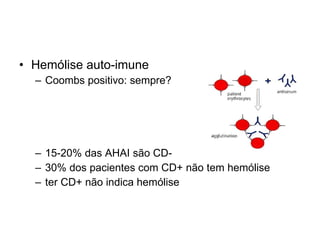 Hemólise auto-imune Coombs positivo: sempre? 15-20% das AHAI são CD- 30% dos pacientes com CD+ não tem hemólise ter CD+ não indica hemólise 