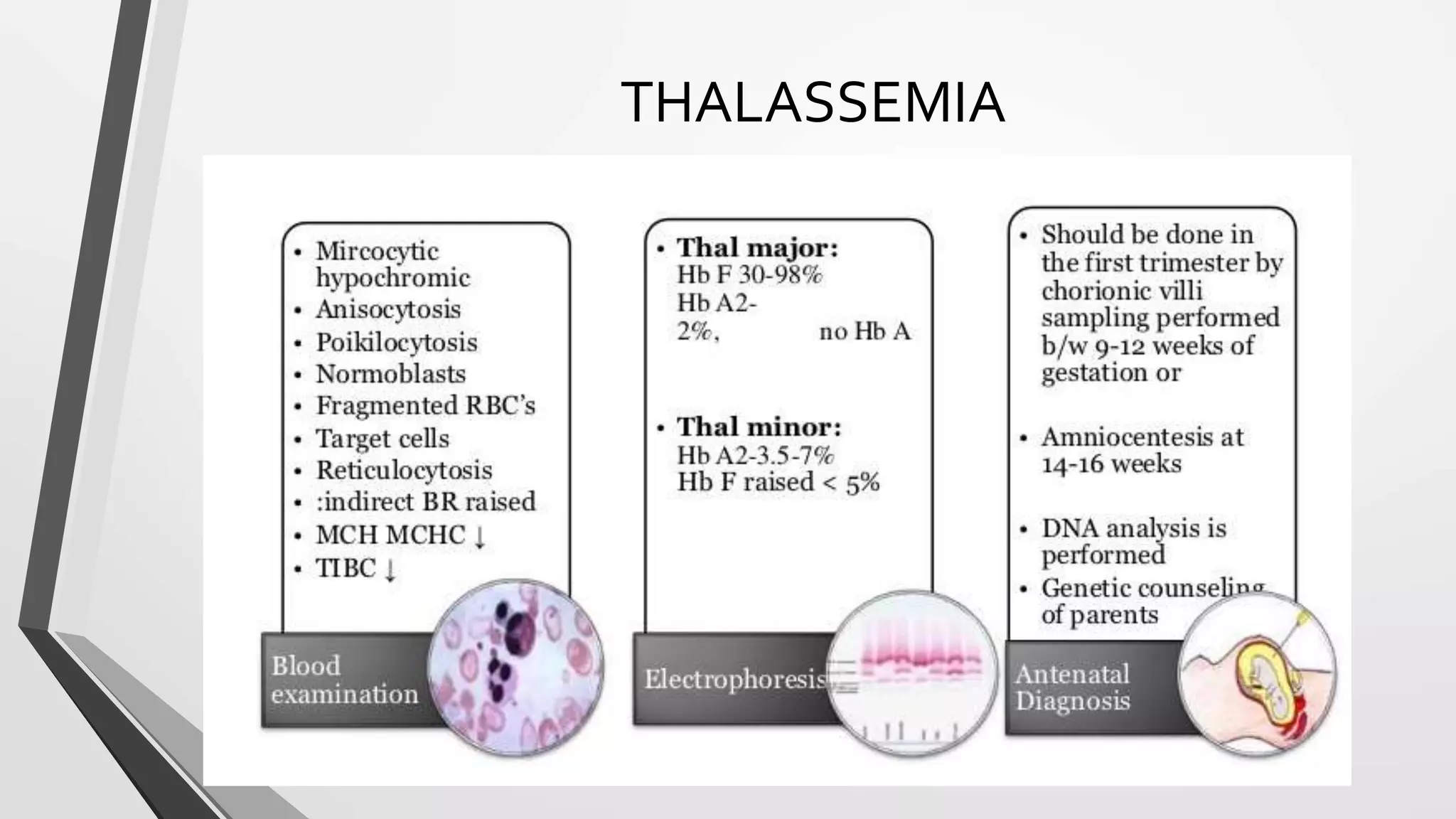 THALASSEMIA
 