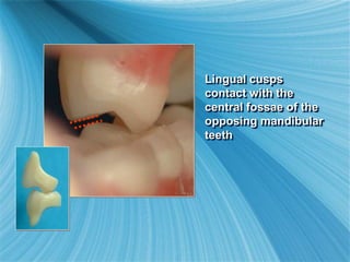 Lingual cusps
contact with the
central fossae of the
opposing mandibular
teeth
 