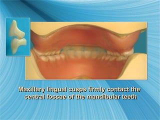 Maxillary lingual cusps firmly contact the
central fossae of the mandibular teeth
 