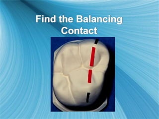 Find the Balancing
Contact
 