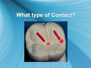 What type of Contact?
 