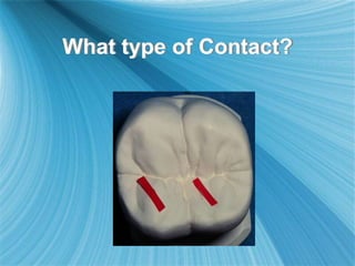 What type of Contact?
 