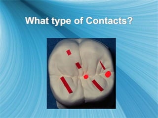 What type of Contacts?
 