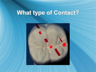 What type of Contact?
 
