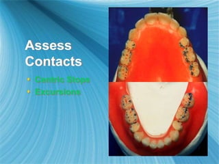 Assess
Contacts
 Centric Stops
 Excursions
 