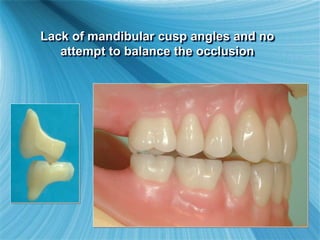 Lack of mandibular cusp angles and no
attempt to balance the occlusion
 