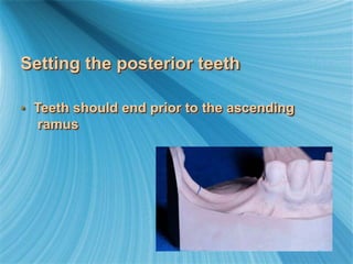 Setting the posterior teeth
• Teeth should end prior to the ascending
ramus
 