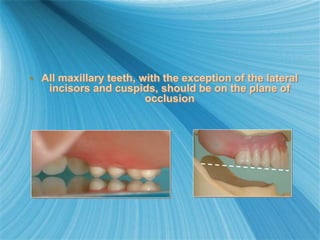 • All maxillary teeth, with the exception of the lateral
incisors and cuspids, should be on the plane of
occlusion
 