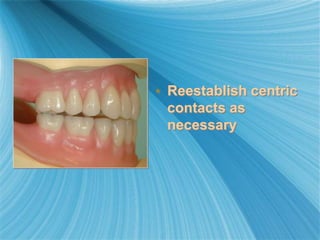 • Reestablish centric
contacts as
necessary
 