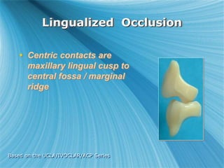 Based on the UCLA/IVOCLAR/ACP Series
Lingualized Occlusion
 Centric contacts are
maxillary lingual cusp to
central fossa / marginal
ridge
 