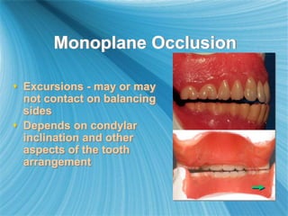 Monoplane Occlusion
 Excursions - may or may
not contact on balancing
sides
 Depends on condylar
inclination and other
aspects of the tooth
arrangement
 