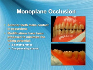 Monoplane Occlusion
 Anterior teeth make contact
in excursions
 Modifications have been
proposed to minimize the
tilting potential:
 Balancing ramps
 Compensating curves
 
