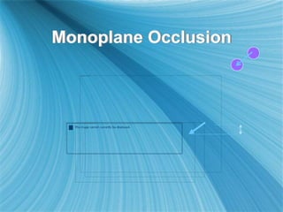 Monoplane Occlusion
 
