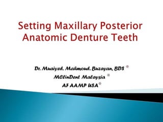Setting maxillary posterior anatomic denture teeth cd 2nd yr
