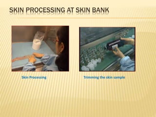 Setting up a Skin Bank | PPTX