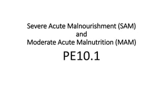 Severe Acute Malnourishment (SAM)
and
Moderate Acute Malnutrition (MAM)
PE10.1
 