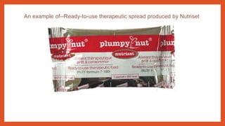 An example of--Ready-to-use therapeutic spread produced by Nutriset
 