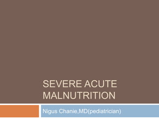 SEVERE ACUTE
MALNUTRITION
Nigus Chanie,MD(pediatrician)
 