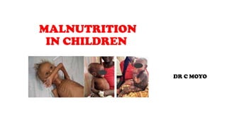 MALNUTRITION
IN CHILDREN
DR C MOYO
 