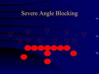 Severe Angle Blocking 