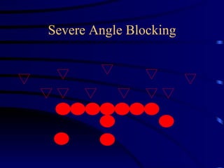 Severe Angle Blocking 