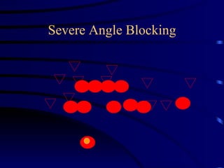 Severe Angle Blocking 