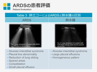 Table 3 肺エコーによるARDSと肺⽔腫の区別
ARDS 肺⽔腫
­ Alveolar-interstitial syndrome
­ Pleural line abnormality
­ Reduction of lung sliding
­ Spared areas
­ Consolidation
­ Small pleural effusion
­ Alveolar-interstitial syndrome
­ Large pleural effusions
­ Homogeneous pattern
ARDSの患者評価
Patient Evaluation
Fig. 1. Lung ultrasound of patient with ARDS.
Note the pleural abnormalities.
Fig. 2. Lung ultrasound of a patient with
hydrostatic edema. Note the thin smooth
pleural line.
 
