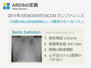 Berlin Definition
1.  急性発症 (7⽇以内)
2.  低酸素⾎症 (P/F <300)
3.  両側の肺浸潤影
4.  ⼼不全だけでは説明が
つかない
ARDSの定義
ARDS definition
2011年のESICM/ATS-SCCM カンファレンス
「以前のALI(急性肺障害)という概念がなくなった.」
JAMA 307:2526−2533, 2012.
 