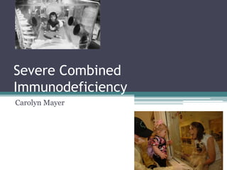 Severe Combined
Immunodeficiency
Carolyn Mayer
 