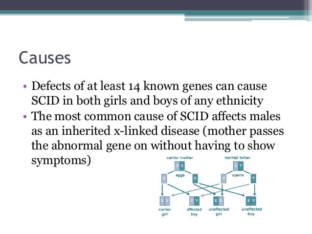 what is scid