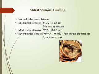 severe mitral stenosis - presentation .. | PPTX