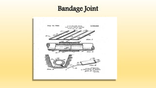 Bandage Joint
 