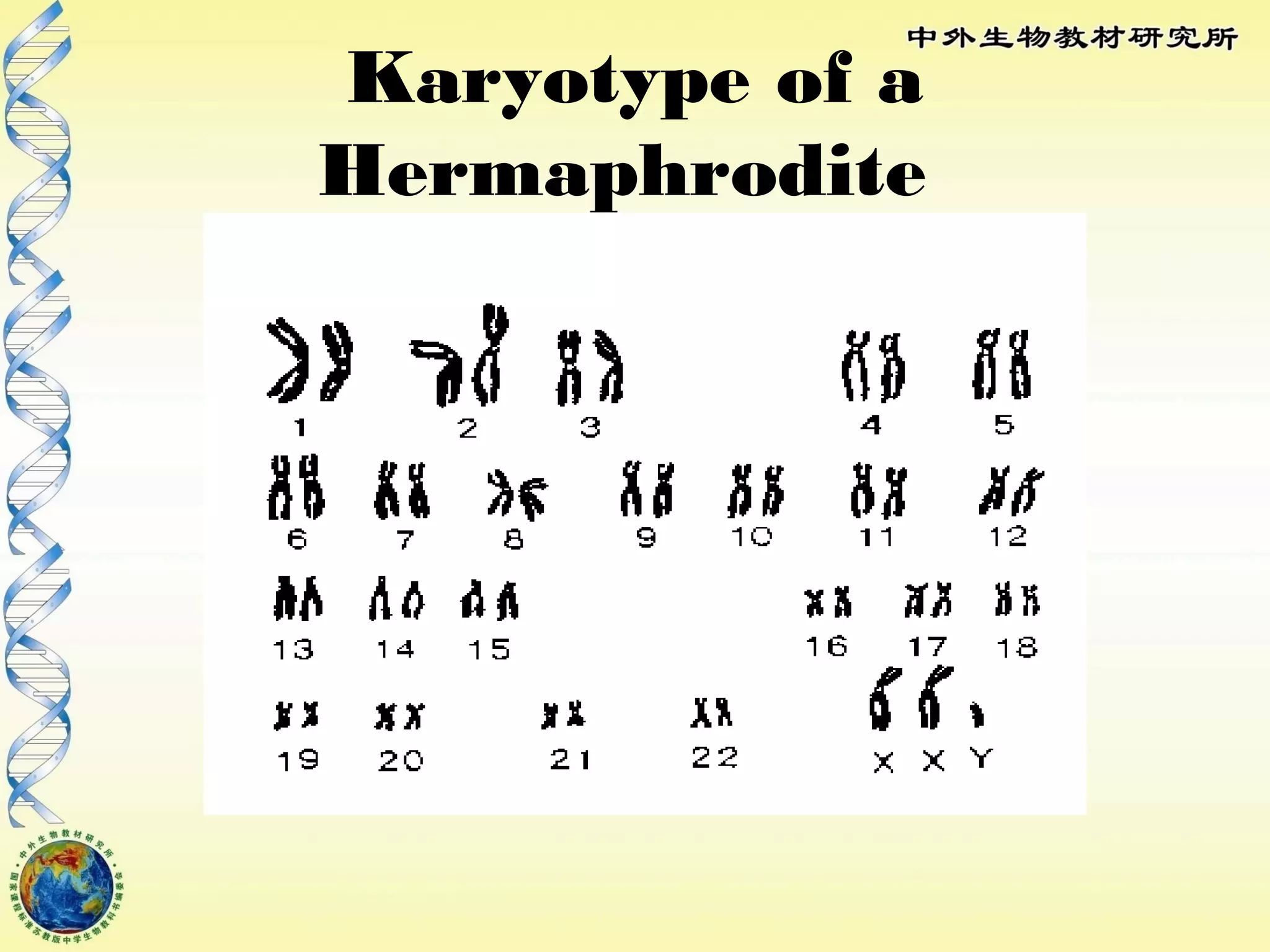 Karyotype of a
Hermaphrodite
 
