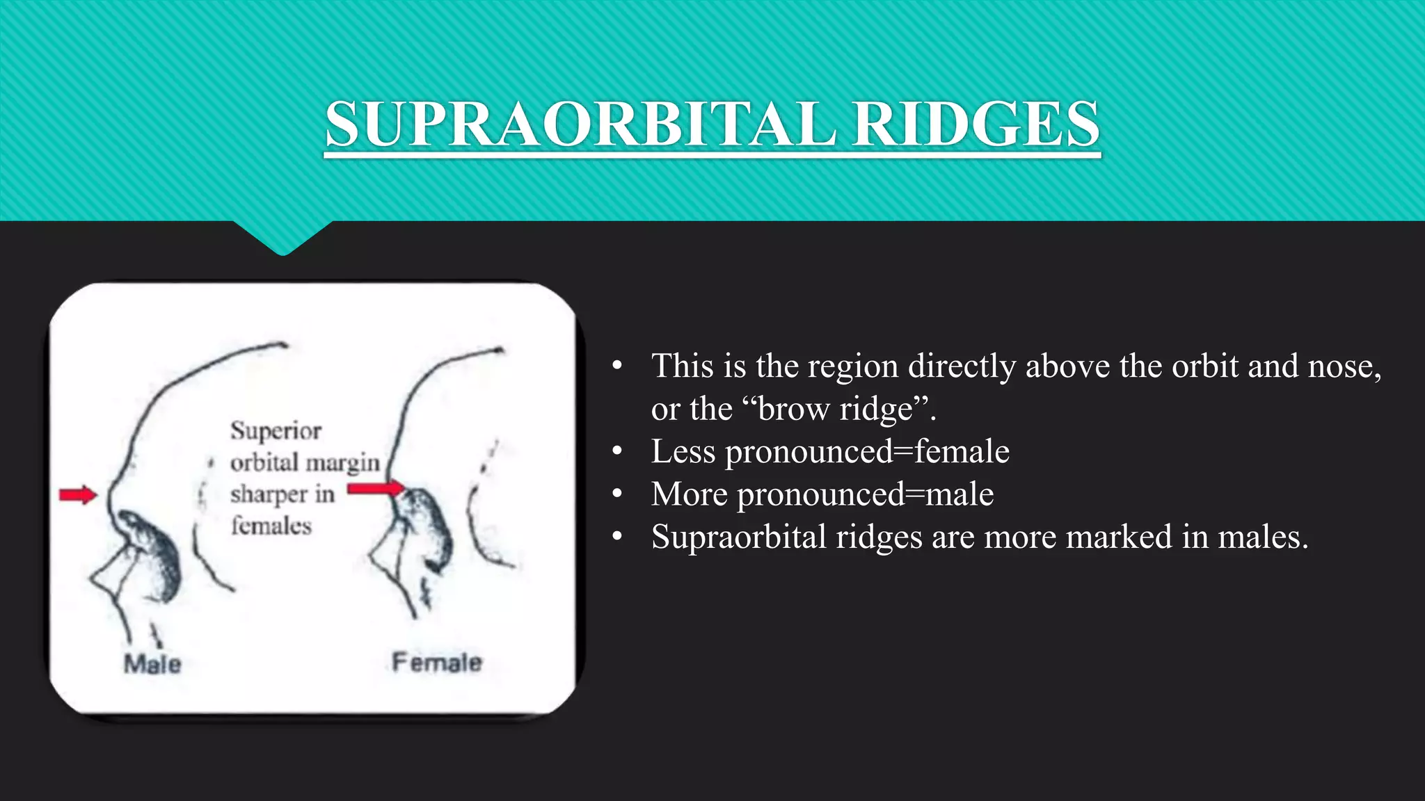 Marked Brow Ridge Sex determination from skull and mandible | PPTX