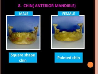 Sex determination in forensic