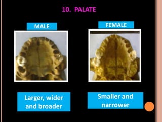 Sex determination in forensic