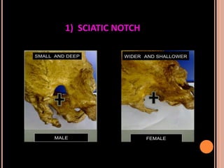 Sex determination in forensic