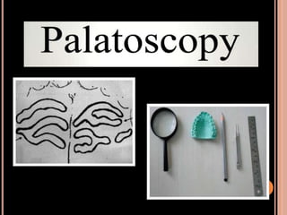 Sex determination in forensic