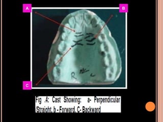 Sex determination in forensic