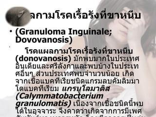 แผลกามโรคเรื้อรังที่ขาหนีบ
• (Granuloma Inguinale; 
  Dovovanosis)
        โรคแผลกามโรคเรือรังที่ขาหนีบ 
                          ้
t




    (donovanosis) มักพบมากในประเทศ
    อินเดียและศรีลังกาและพบบ้างในประเท
    ศอื่นๆ ส่วนประเทศพบจำานวนน้อย เกิด
    จากเชื้อแบคทีเรียชนิดแกรมลบคัมลิมมา
    โตแบคทีเรียม แกรนูโลมาติส 
    (Calymmatobacterium 
    granulomatis) เนื่องจากเชื้อชนิดนี้พบ
    ได้ในอุจจาระ จึงคาดว่าเกิดจากการมีเพศ
 