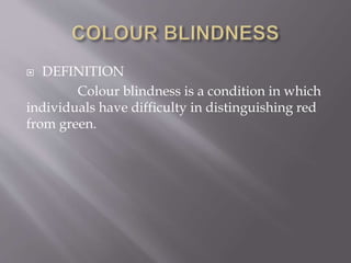  DEFINITION
Colour blindness is a condition in which
individuals have difficulty in distinguishing red
from green.
 
