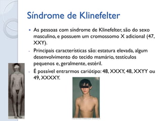 Síndrome de Klinefelter 
As pessoas com síndrome de Klinefelter, são do sexo masculino, e possuem um cromossomo X adicional (47, XXY). 
-Principais características são: estatura elevada, algum desenvolvimento do tecido mamário, testículos pequenos e, geralmente, estéril. 
-É possível entrarmos cariótipo: 48, XXXY, 48, XXYY ou 49, XXXXY.  