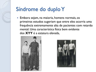 Síndrome do duplo Y 
Embora sejam, na maioria, homens normais, os primeiros estudos sugeriam que entre eles ocorria uma frequência extremamente alta de pacientes com retardo mental. Uma característica física bem evidente dos XYY é a estatura elevada,  