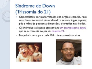 Síndrome de Patau (Trissomia do 13) 
É clinicamente grave e letal em quase todos os casos que sobrevivem até 6 meses de i...